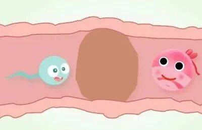 輸卵管這兩個部位容易堵塞，備孕女性要注意